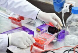 ĐIỆN DI GEL LÀ GÌ? NGUYÊN LÝ, ỨNG DỤNG VÀ CÁCH CHỌN HỆ THỐNG ĐIỆN DI PHÙ HỢP
